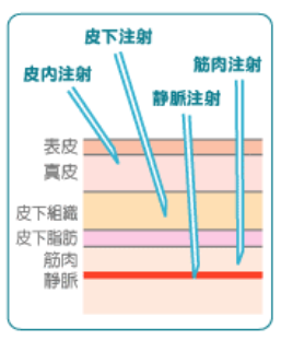 注射の深度