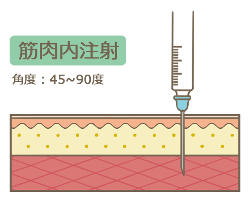 筋肉内注射(筋注)