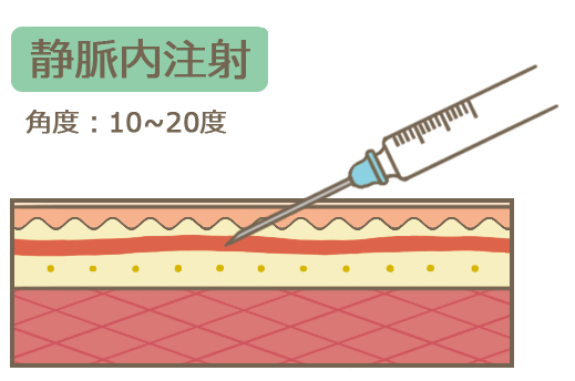 静脈内注射