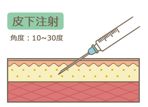 皮下注射(皮下注)